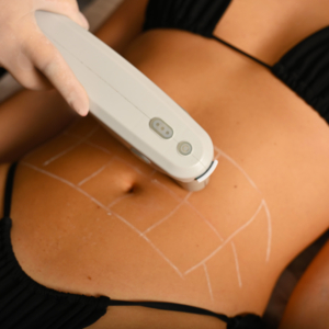 Has POWERSHAPE kezelés